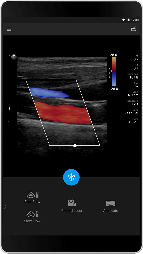 Vasculair onderzoek L12-4