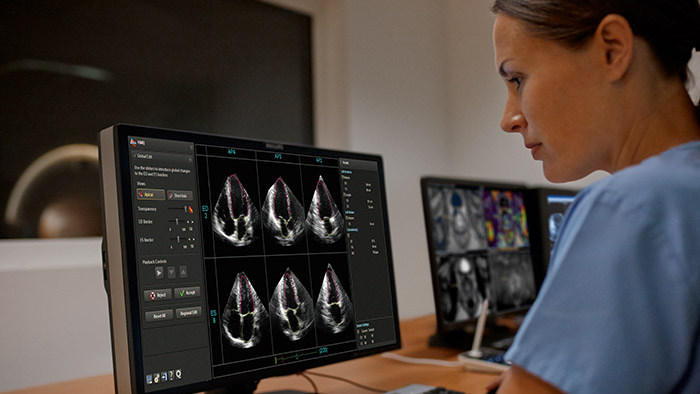 3D echografie